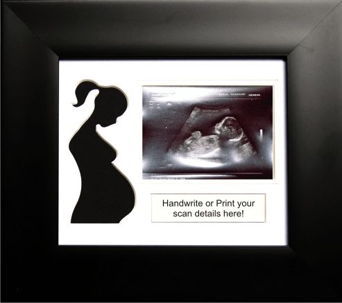 Image of Baby Scan Ultrasound Sonogram Photo Frame Black - White